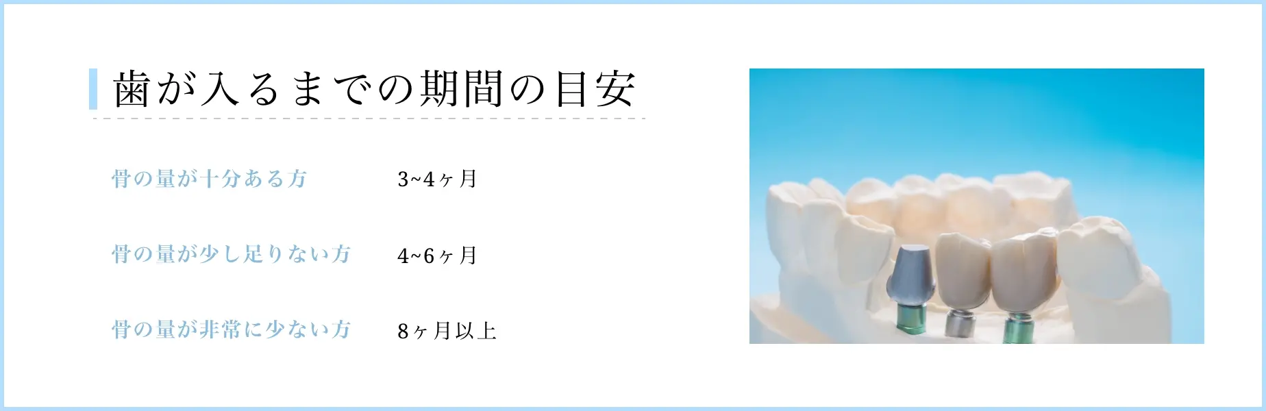 歯が入るまでの目安期間